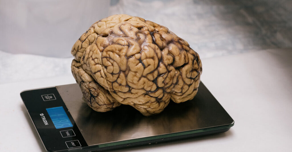 An N.F.L. Doctor Wants to Know Why Some Players Get C.T.E. and Others Don’t