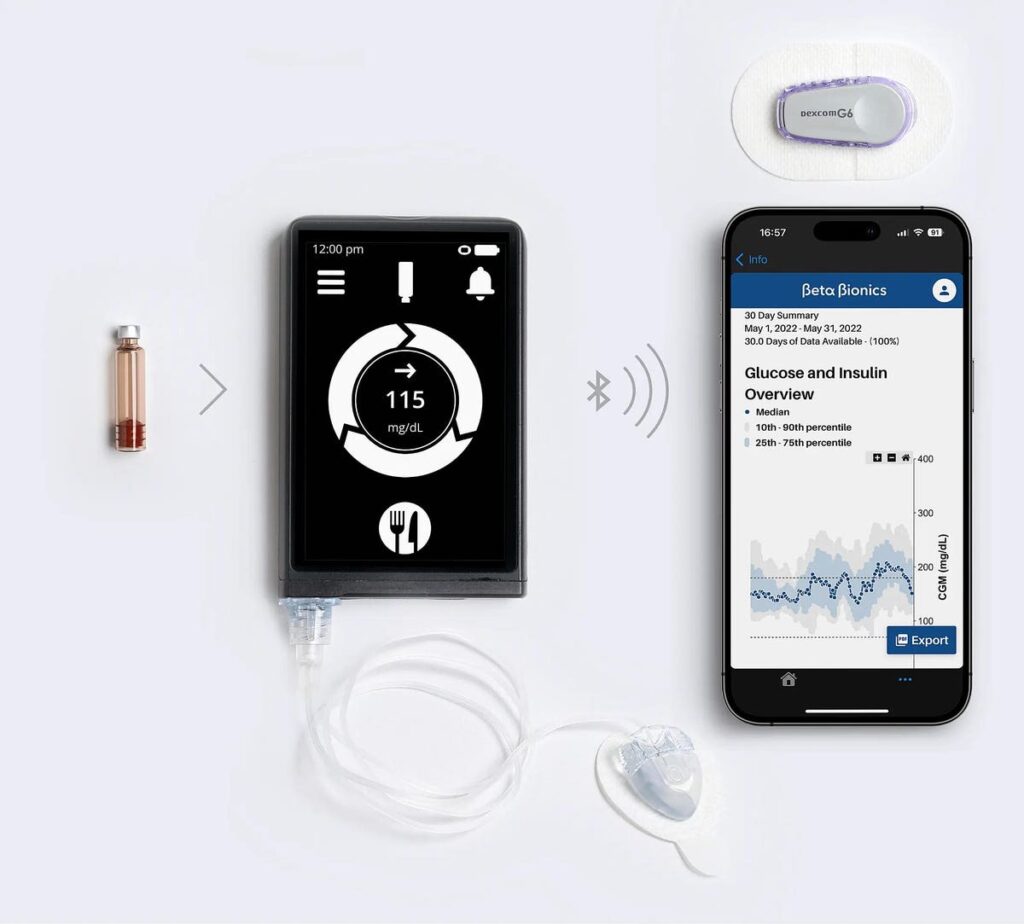 Simplifying Diabetes Control With The iLet Bionic Pancreas