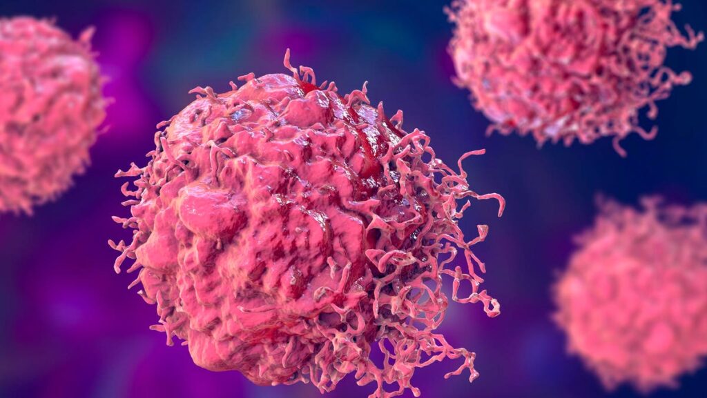 Cancer Rates Among Americans Under 50 Are Slightly Rising, New Study Finds