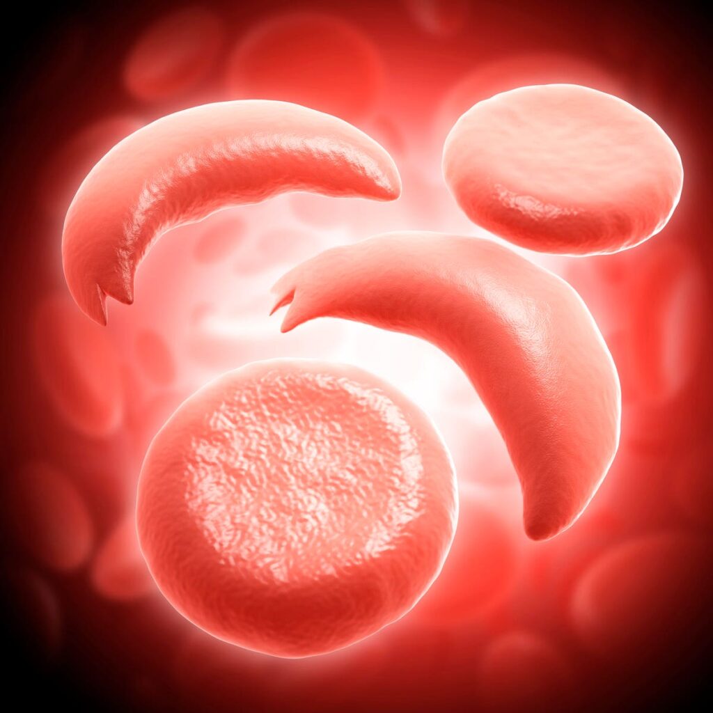 How mRNA Could Cure Sickle Cell Gene Mutations