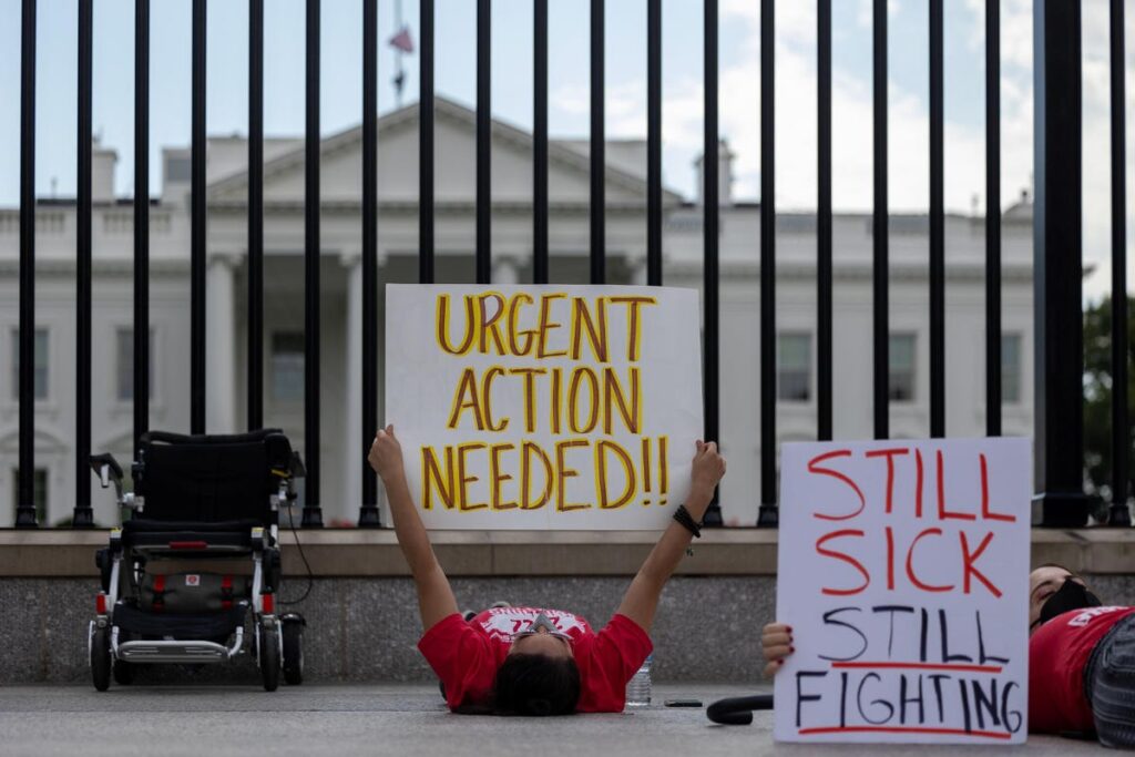 Purple Discoloration Of Legs Could Be An Unusual Symptom