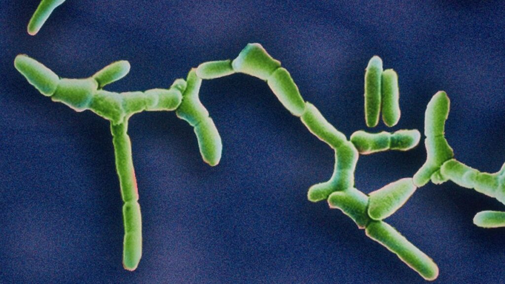 Washington State Listeria Outbreak Linked To Milkshakes—Symptoms, Treatment And Who’s At Risk