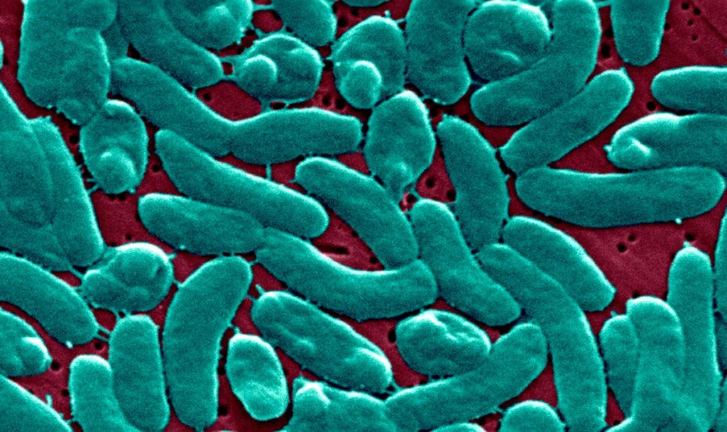What To Know About Vibrio Vulnificus Infection