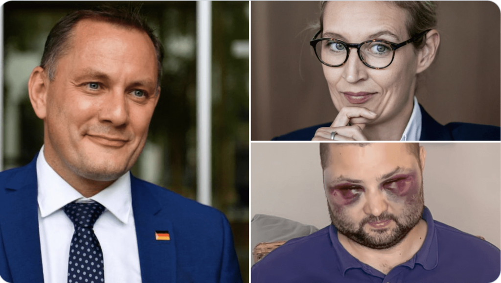 NOT MAKING HEADLINES - The Life-Threatening Attacks on Germany's AfD Party Members - MP Petr Bystron Describes the Poisoning, Beatings and a SHOCKING STORY OF HIS OWN as AfD Populist Party Members are Targeted and Hunted by the German Left (VIDEO) | The Gateway Pundit