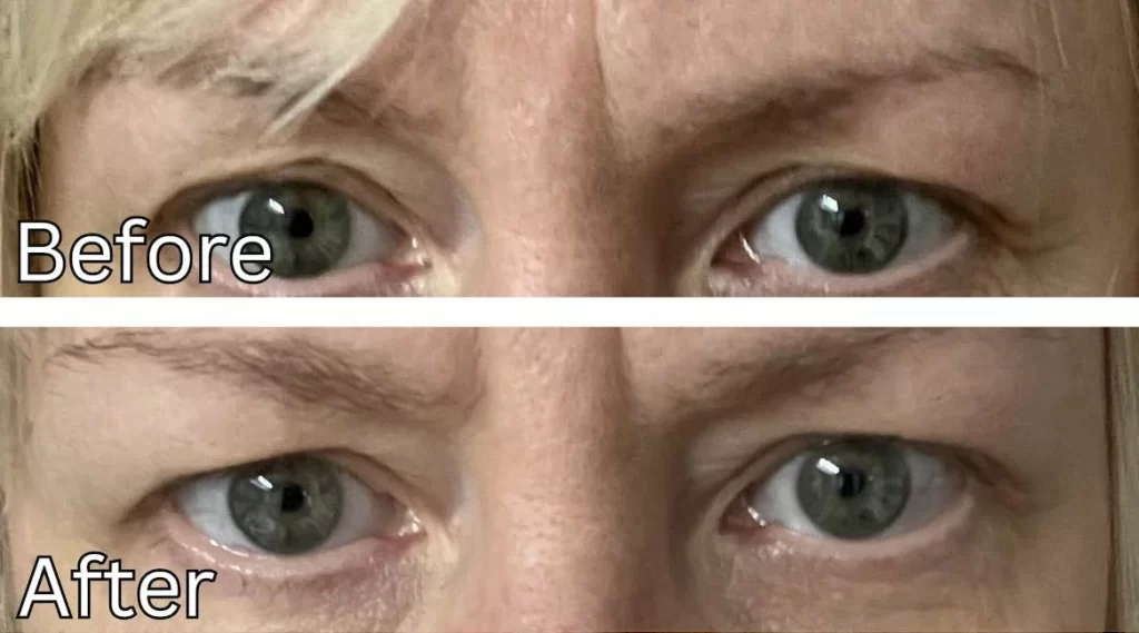 Nurive CoreVital Advanced Wrinkle Patches Review| Well+Good