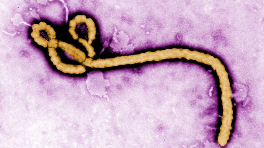 Ebola, hepatitis B, long Covid, Christianity: Morning Rounds Ebola, hepatitis B, long Covid, Christianity: Morning Rounds