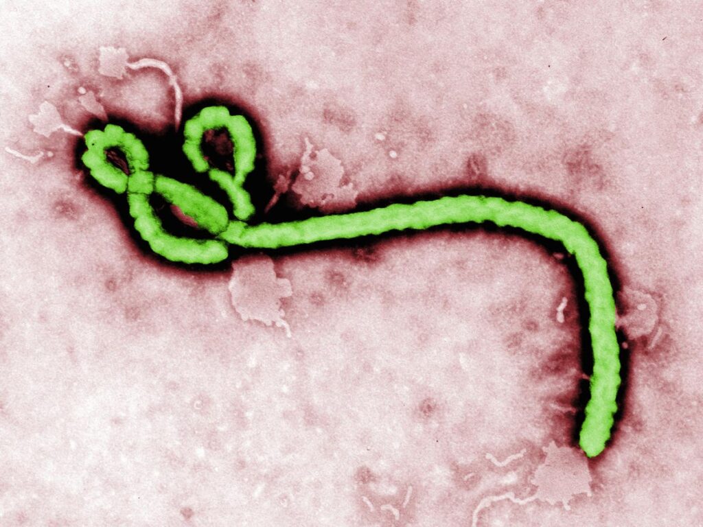There’s An Ebola Outbreak. Here’s What Could Happen Next, From A Doctor