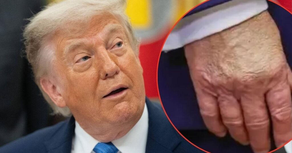 Everything to Know About Donald Trump’s Health Amid Rising Concerns Everything to Know About Donald Trump's Health Amid Rising Concerns