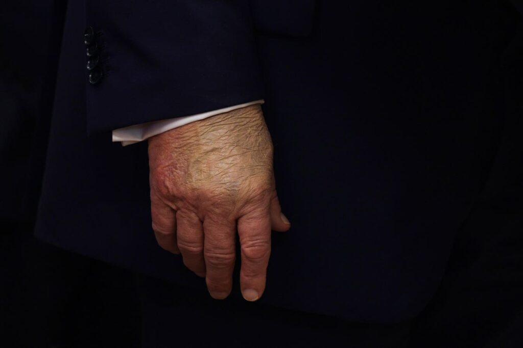 Lingering Questions After President Trump’s Physical And Health Checkup Lingering Questions After President Trump’s Physical And Health Checkup