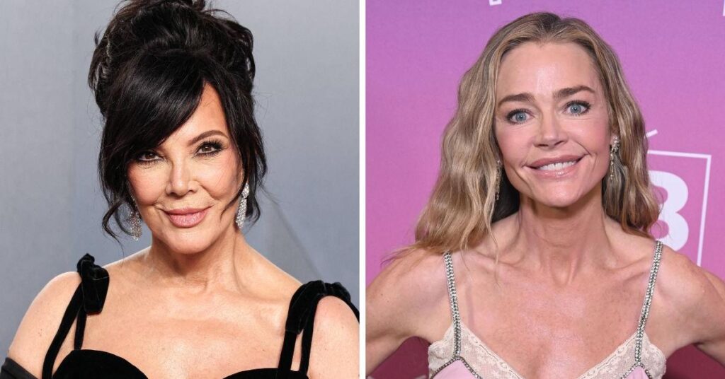 Radar Reveals the Most Shocking Celebrity Facelift Transformations