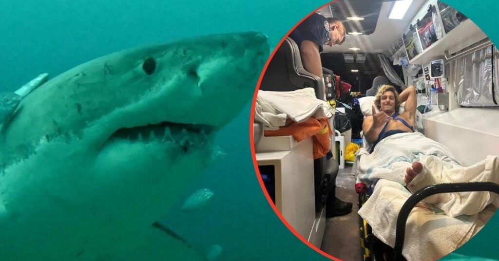 Shark Attack Survivor Reveals Move He Used To Escape Deadly Encounter Shark Attack Survivor Reveals Move He Used To Escape Deadly Encounter
