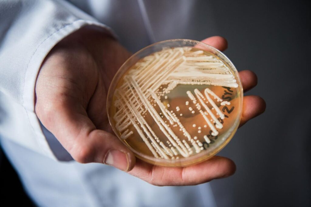 A Drug-Resistant Fungus Is Spreading Through American Hospitals A Drug-Resistant Fungus Is Spreading Through American Hospitals