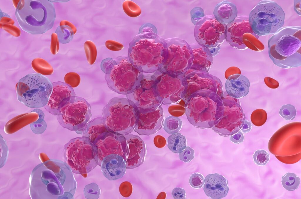 A New Antibody Is Effective In Acute Lymphoblastic Leukemia