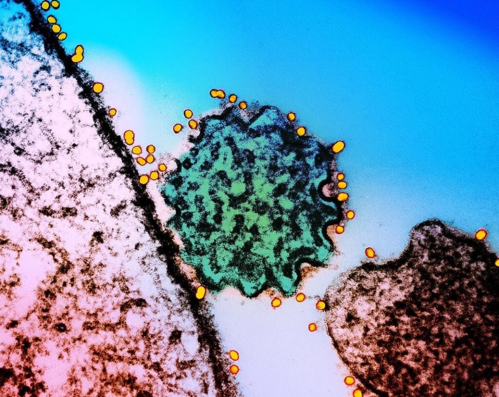 A Two-Antibody Cocktail Targets Two Of The World’s Deadliest Viruses A Two-Antibody Cocktail Targets Two Of The World’s Deadliest Viruses