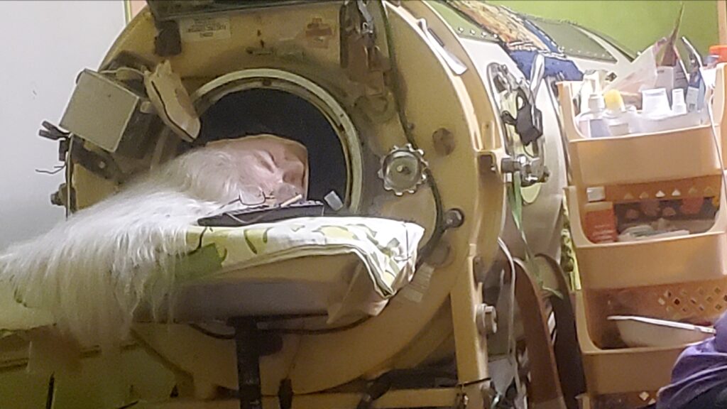 Last U.S. polio patient using iron lung dies at 78 Last U.S. polio patient using iron lung dies at 78