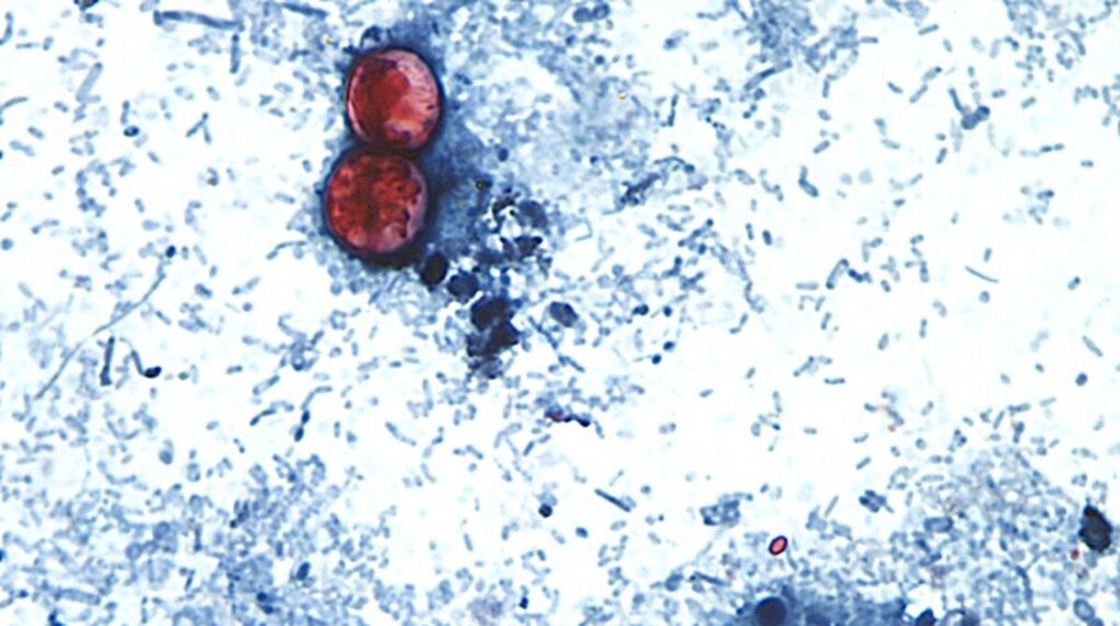 Lettuce At Taco Bell In 5 States Confirmed As A Source Of Diarrhea-Causing Parasite Lettuce At Taco Bell In 5 States Confirmed As A Source Of Diarrhea-Causing Parasite