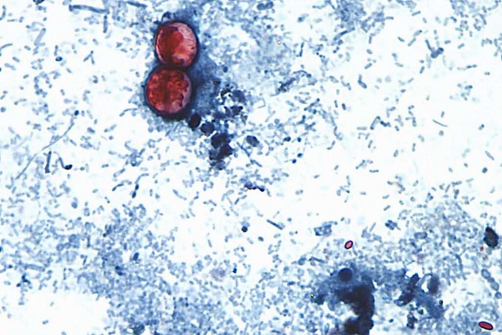 Mastercard Patented A Tool That Could Have Cracked This Summer’s Cyclospora Outbreak. It Was Never Deployed Mastercard Patented A Tool That Could Have Cracked This Summer's Cyclospora Outbreak. It Was Never Deployed