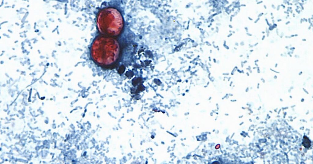 Michigan Battles Massive Cyclosporiasis Outbreak As State Reels From Trump Cuts Michigan Battles Massive Cyclosporiasis Outbreak As State Reels From Trump Cuts