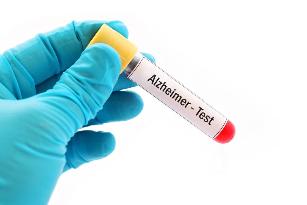 New Alzheimer’s Blood Tests Are Easy. But Do You Really Want One? New Alzheimer’s Blood Tests Are Easy. But Do You Really Want One?