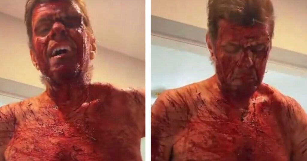 SHOCK: Celebrity Blogger Perez Hilton Self-Harms on TikTok Livestream – Fully Nude, Covered in Blood – Taken Away by Ambulance SHOCK: Celebrity Blogger Perez Hilton Self-Harms on TikTok Livestream – Fully Nude, Covered in Blood – Taken Away by Ambulance