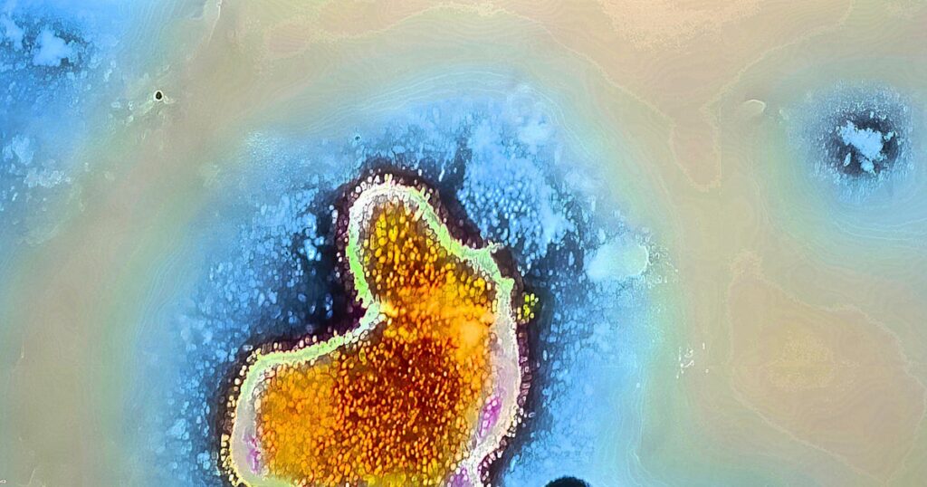 North Carolina Teen Dies From Brain-Eating Amoeba North Carolina Teen Dies From Brain-Eating Amoeba