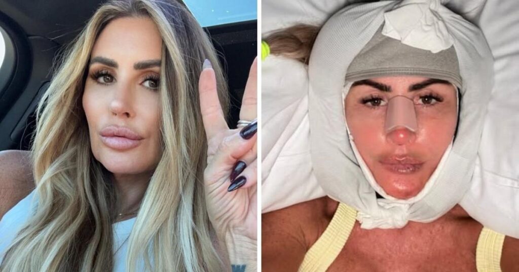 Tiger Woods’ Ex-Mistress’ Facelift Transformation Exposed in Photos Tiger Woods' Ex-Mistress' Facelift Transformation Exposed in Photos
