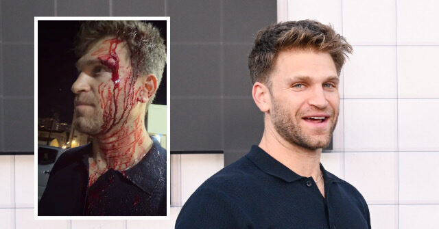 ‘Pretty Little Liars’ Star Keegan Allen Robbed at Gunpoint Outside Luxury Hollywood Grocery Store